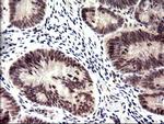 PMS2 Antibody in Immunohistochemistry (Paraffin) (IHC (P))