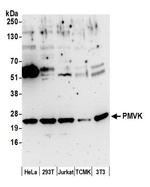 PMVK Polyclonal Antibody