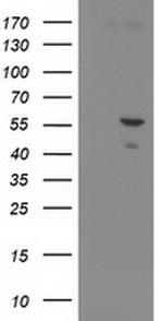 PNMA3 Antibody in Western Blot (WB)