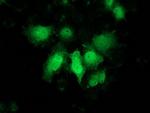 PNMT Antibody in Immunocytochemistry (ICC/IF)