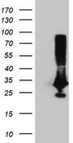PNMT Antibody in Western Blot (WB)