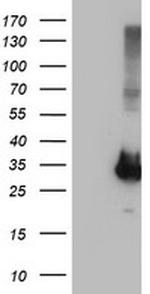 PNMT Antibody in Western Blot (WB)