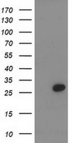 PNMT Antibody in Western Blot (WB)