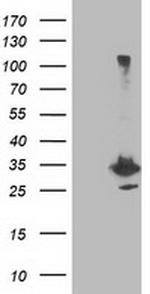 PNMT Antibody in Western Blot (WB)