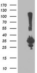 PNMT Antibody in Western Blot (WB)