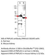 PNPLA3 Polyclonal Antibody