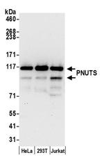 PNUTS Antibody in Western Blot (WB)