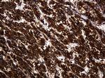 POGK Antibody in Immunohistochemistry (Paraffin) (IHC (P))