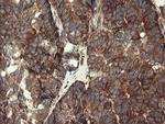 POGK Antibody in Immunohistochemistry (Paraffin) (IHC (P))