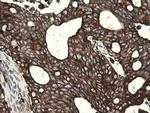 POGK Antibody in Immunohistochemistry (Paraffin) (IHC (P))