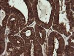 POGK Antibody in Immunohistochemistry (Paraffin) (IHC (P))