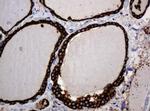 POGK Antibody in Immunohistochemistry (Paraffin) (IHC (P))