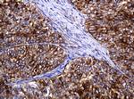 POGK Antibody in Immunohistochemistry (Paraffin) (IHC (P))