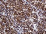 POGK Antibody in Immunohistochemistry (Paraffin) (IHC (P))