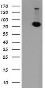 POGK Antibody in Western Blot (WB)