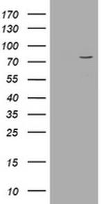 POGK Antibody in Western Blot (WB)