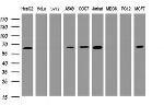 POGK Antibody in Western Blot (WB)