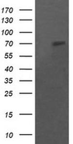 POGK Antibody in Western Blot (WB)