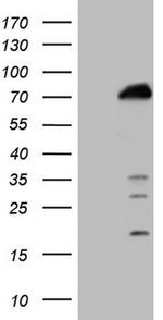 POLA2 Antibody in Western Blot (WB)