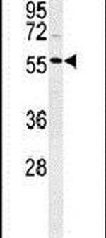 POLL Antibody in Western Blot (WB)