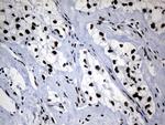POLR2A Antibody in Immunohistochemistry (Paraffin) (IHC (P))