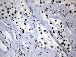 POLR2A Antibody in Immunohistochemistry (Paraffin) (IHC (P))