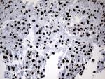 POLR2A Antibody in Immunohistochemistry (Paraffin) (IHC (P))