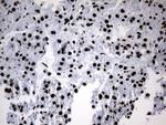 POLR2A Antibody in Immunohistochemistry (Paraffin) (IHC (P))