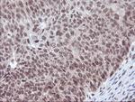 POLR2E Antibody in Immunohistochemistry (Paraffin) (IHC (P))