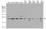 POLR2G Antibody in Western Blot (WB)