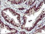 POLR3GL Antibody in Immunohistochemistry (Paraffin) (IHC (P))