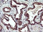POLR3GL Antibody in Immunohistochemistry (Paraffin) (IHC (P))