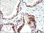 POLR3GL Antibody in Immunohistochemistry (Paraffin) (IHC (P))