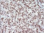 POLR3GL Antibody in Immunohistochemistry (Paraffin) (IHC (P))
