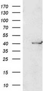 PON1 Antibody in Western Blot (WB)