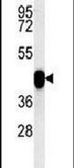PON2 Antibody in Western Blot (WB)