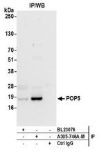 POP5 Polyclonal Antibody
