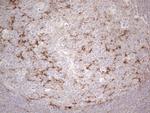 POTEG Antibody in Immunohistochemistry (Paraffin) (IHC (P))