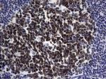 POU2AF1 Antibody in Immunohistochemistry (Paraffin) (IHC (P))