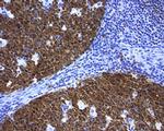 POU2AF1 Antibody in Immunohistochemistry (Paraffin) (IHC (P))
