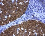 POU2AF1 Antibody in Immunohistochemistry (Paraffin) (IHC (P))