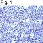 OCT1 (POU2F1) Antibody in Immunohistochemistry (IHC)