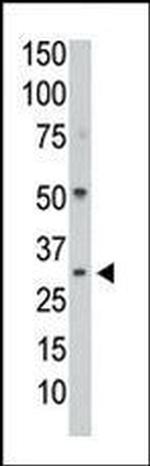 PP1 gamma Antibody in Western Blot (WB)