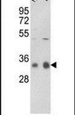 PP1 gamma Antibody in Western Blot (WB)