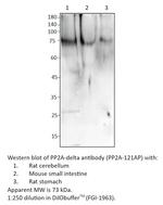 PP2A-delta Polyclonal Antibody