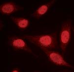 PPP2R1A Polyclonal Antibody