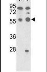 PP5 Antibody in Western Blot (WB)