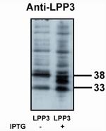 PPAP2B Polyclonal Antibody