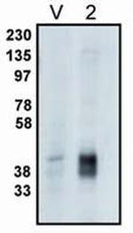 PPAP2C Polyclonal Antibody