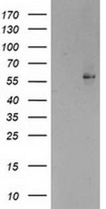 PPARA Antibody in Western Blot (WB)